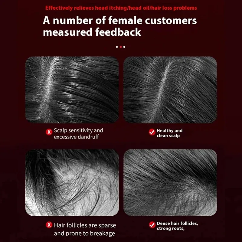 Escova de Massagem Elétrica Vi - Hair Care For Hair Loss avaliação e preço