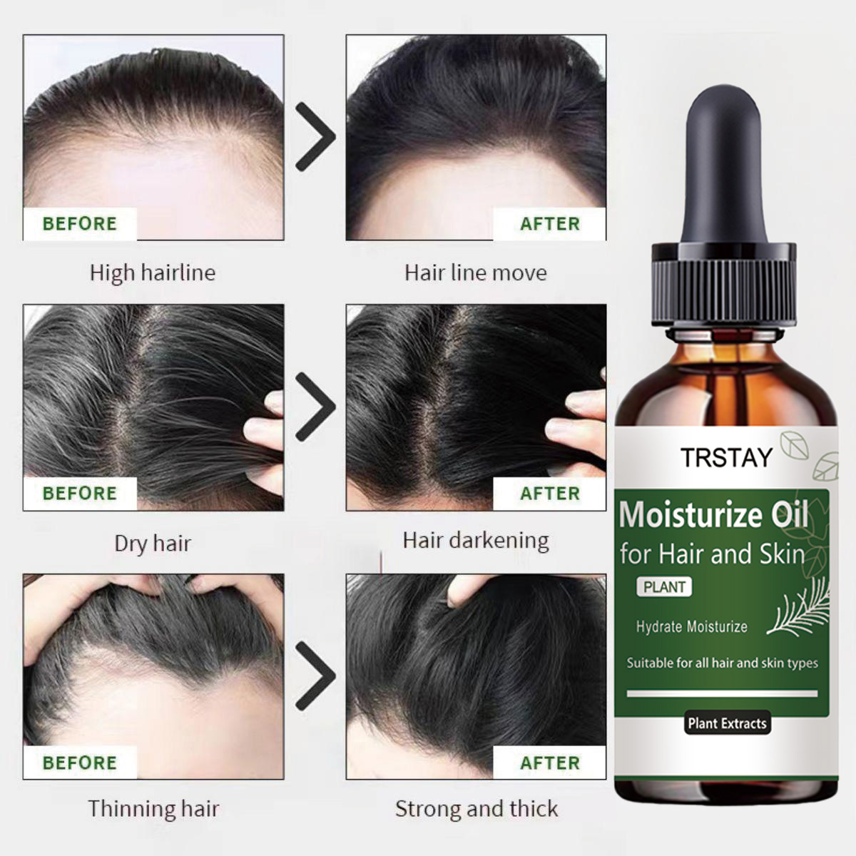 Trstay óleo essencial de alecr - Rosemary Hair Oil avaliação e preço