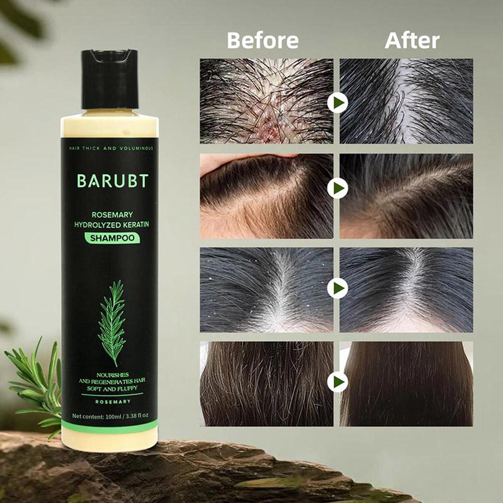 Shampoo de alecrim para cresci - Rosemary Hair Oil avaliação e preço