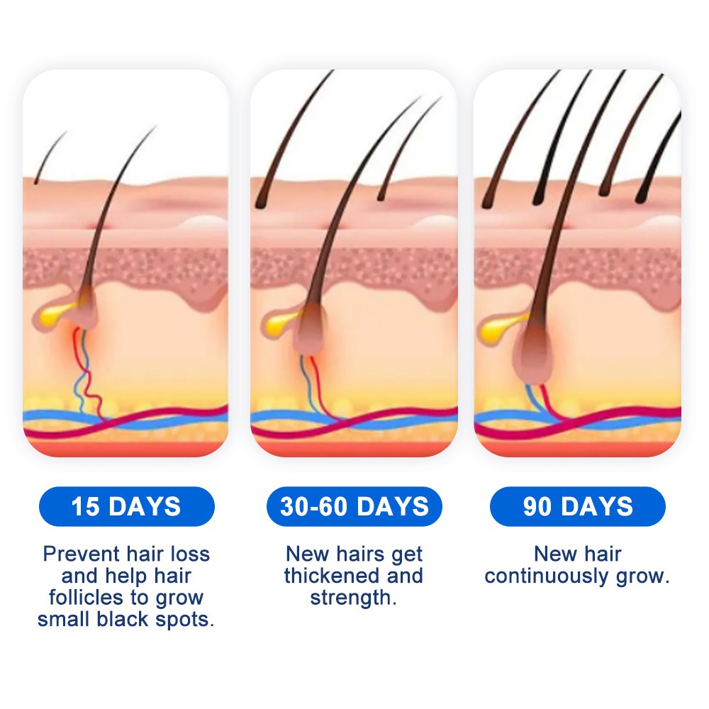 Alopecia spray de crescimento  - Hair Care Spray avaliação e preço