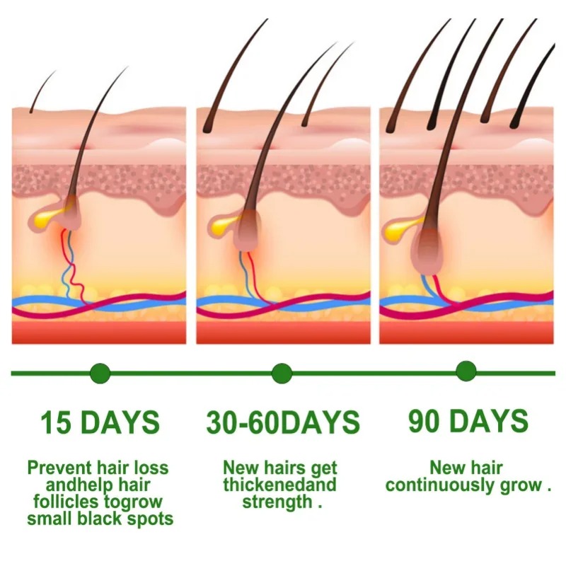 Soro de crescimento capilar, c - Hair Care Fragrance Essential Oil avaliação e preço