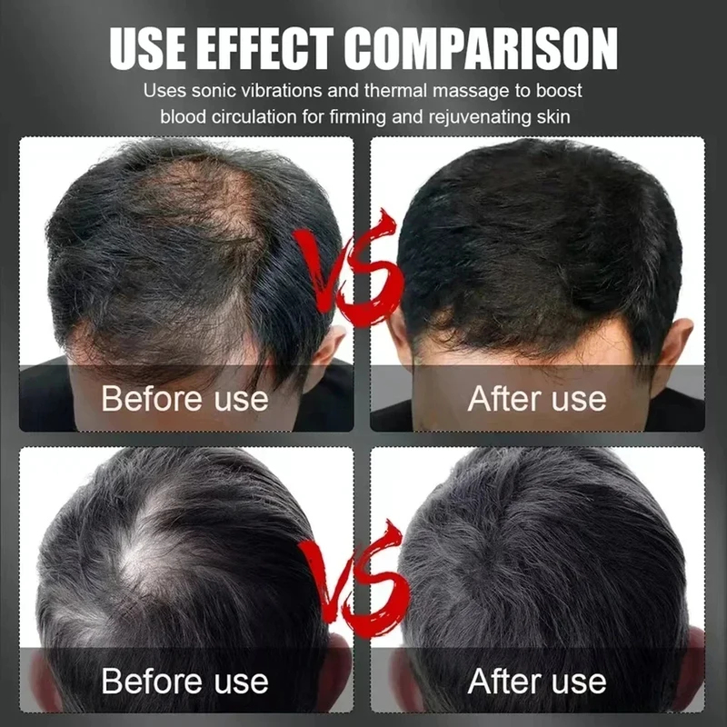 Boné Terapêutico de Luz Vermel - Hair Care For Hair Loss avaliação e preço